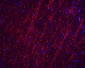 PDL-1 Antibody